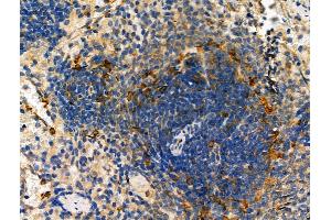 ABIN6261515 and ABIN6278456 at 1/100 staining Rat spleen tissue by IHC-P. (ELMO1 抗体  (C-Term))