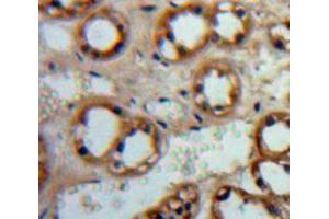 IHC-P analysis of Adrenal tissue, with DAB staining. (ADCY1 抗体  (AA 835-1061))