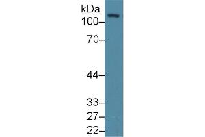 Detection of FAK in Human K562 cell lysate using Polyclonal Antibody to Focal Adhesion Kinase (FAK)