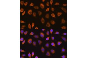 Immunofluorescence analysis of L929 cells using SEL1L antibody (ABIN6132642, ABIN6147499, ABIN6147500 and ABIN6215644) at dilution of 1:100. (SEL1L 抗体  (AA 22-190))