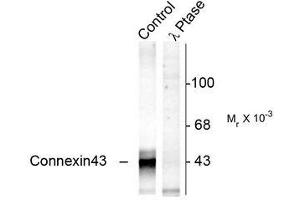 Image no. 1 for anti-Gap Junction Protein, alpha 1, 43kDa (GJA1) (pSer368) antibody (ABIN372603)