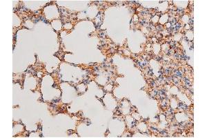 Immunohistochemistry (IHC) image for anti-GATA Binding Protein 4 (GATA4) (pSer105) antibody (ABIN6256094)
