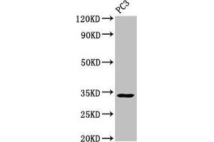Western Blot Positive WB detected in: PC-3 whole cell lysate All lanes: STX1A antibody at 3 μg/mL Secondary Goat polyclonal to rabbit IgG at 1/50000 dilution Predicted band size: 34, 30, 29 kDa Observed band size: 34 kDa (STX1A 抗体  (AA 1-265))