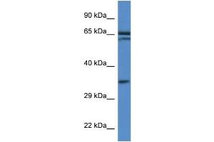 WB Suggested Anti-Terf2ip Antibody Titration: 1. (RAP1 抗体  (Middle Region))