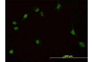 Image no. 3 for anti-Pre-B-Cell Leukemia Homeobox Protein 1 (PBX1) (AA 213-322) antibody (ABIN598855) (PBX1 抗体  (AA 213-322))
