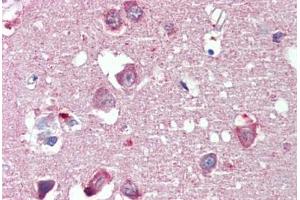 Brain, cortex, Human: Formalin-Fixed, Paraffin-Embedded (FFPE) (Reticulon 4 抗体  (AA 501-515))