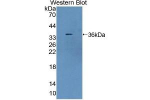 Western blot analysis of the recombinant protein. (TLR8 抗体  (AA 519-812))