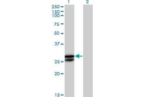 Western Blot analysis of OSM expression in transfected 293T cell line by OSM MaxPab polyclonal antibody. (Oncostatin M 抗体  (AA 1-252))