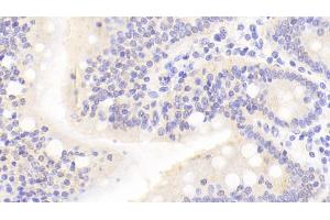 Immunohistochemistry (IHC) image for anti-Neurotrophic tyrosine Kinase, Receptor, Type 3 (NTRK3) (AA 32-429) antibody (ABIN7443641)