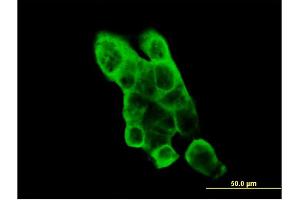 Immunofluorescence of monoclonal antibody to EPHA2 on A-431 cell.