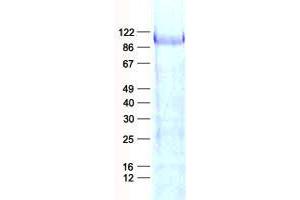 Validation with Western Blot (AFAP Protein (His tag))