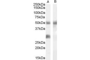 Western Blotting (WB) image for anti-Dual Specificity Phosphatase 11 (RNA/RNP Complex 1-Interacting) (DUSP11) (Middle Region) antibody (ABIN2778853) (DUSP11 抗体  (Middle Region))