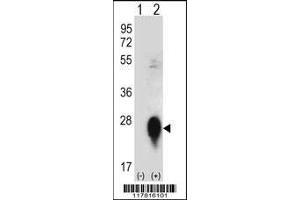 Western blot analysis of CLEC3B using rabbit polyclonal CLEC3B Antibody using 293 cell lysates (2 ug/lane) either nontransfected (Lane 1) or transiently transfected (Lane 2) with the CLEC3B gene. (CLEC3B 抗体  (AA 95-122))
