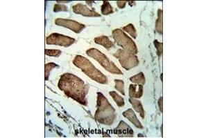 Formalin-fixed and paraffin-embedded human skeletal muscle reacted with LMOD1 Antibody (Center ), which was peroxidase-conjugated to the secondary antibody, followed by DAB staining. (Leiomodin 1 抗体  (AA 214-241))