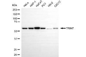 Western blotting analysis using TRIM7 antibody (ABIN7800643). (TRIM7 抗体)