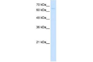 WB Suggested Anti-CTPS Antibody Titration:  5. (CTP Synthase 抗体  (C-Term))