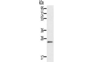 Gel: 10 % SDS-PAGE, Lysate: 40 μg, Lane: Human heart tissue, Primary antibody: ABIN7192155(RBM38 Antibody) at dilution 1/200, Secondary antibody: Goat anti rabbit IgG at 1/8000 dilution, Exposure time: 1 minute (RBM38 抗体)