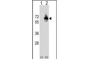 Western blot analysis of PCK2 (arrow) using rabbit polyclonal PCK2 Antibody (Q39) (ABIN392678 and ABIN2842171). (PEPCK 抗体  (N-Term))