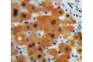Used in DAB staining on fromalin fixed paraffin-embedded Liver tissue (CSTB 抗体  (AA 1-98))