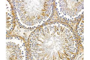 ABIN7095914 and ABIN7099976 at 1/100 staining rat testis tissue by IHC-P. (CCSER1 抗体)