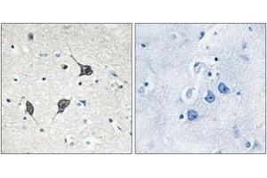 Immunohistochemistry analysis of paraffin-embedded human brain tissue, using GPR20 Antibody. (GPR20 抗体  (AA 291-340))