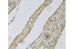 Immunohistochemistry of paraffin-embedded Human smooth muscle using PRNP Polyclonal Antibody at dilution of 1:100 (40x lens). (PRNP 抗体)