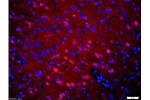 Formalin-fixed and paraffin embedded rat brain labeled with Rabbit Anti-5HT2A Receptor/SR-2A Polyclonal Antibody, Unconjugated at 1:200 followed by conjugation to the secondary antibody, Goat Anti-Rabbit IgG, Cy3 conjugated used at 1:200 dilution for 40 minutes at 37 °C. (HTR2A 抗体  (AA 51-150))
