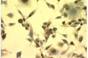 Immunocytochemistry/Immunofluorescence analysis using Mouse Anti-Hsp70 Monoclonal Antibody, Clone C92 . (HSP70 抗体  (HRP))