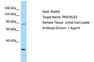 Image no. 1 for anti-Prickle Homolog 2 (PRICKLE2) (C-Term) antibody (ABIN6749993) (PRICKLE2 抗体  (C-Term))
