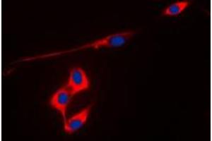 Immunofluorescent analysis of Peroxiredoxin 3 staining in MCF7 cells.