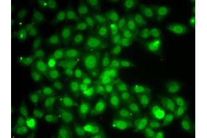 Immunofluorescence analysis of A549 cell using TRAF4 antibody.