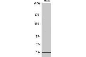 Western Blotting (WB) image for anti-Ets Variant 1 (ETV1) (N-Term) antibody (ABIN3174998) (ETV1 抗体  (N-Term))