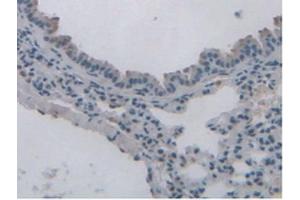 IHC-P analysis of Mouse Lung Tissue, with DAB staining. (Leptin Receptor 抗体  (AA 22-203))