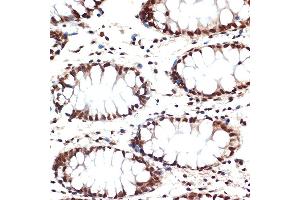 Immunohistochemistry of paraffin-embedded human colon using CDC16 Rabbit mAb (ABIN1678585, ABIN3017837, ABIN3017838 and ABIN7101525) at dilution of 1:100 (40x lens). (CDC16 抗体)