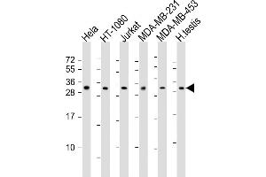 All lanes : Anti-SSX2 Antibody (Center) at 1:2000 dilution Lane 1: Hela whole cell lysates Lane 2: HT-1080 whole cell lysates Lane 3: Jurkat whole cell lysates Lane 4: MDA-MB-231 whole cell lysates Lane 5: MDA-MB-453 whole cell lysates Lane 6: human testis lysates Lysates/proteins at 20 μg per lane. (SSX2 抗体  (AA 110-142))