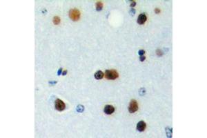 Immunohistochemical analysis of ICER staining in human brain formalin fixed paraffin embedded tissue section. (CREM 抗体  (Center))