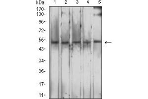 Western blot analysis using CD204 mouse mAb against PC-2 (1), A549 (2), HepG2 (3), L-02 (4), and PANC-1 (5) cell lysate.