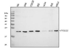 Western blot analysis of p23/PTGES3 using anti-p23/PTGES3 antibody (ABIN7599548).