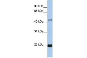 WB Suggested Anti-ZNF581 Antibody Titration:  0. (ZNF581 抗体  (Middle Region))