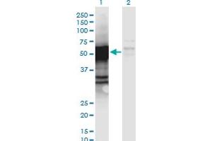 Western Blot analysis of PGCP expression in transfected 293T cell line by PGCP monoclonal antibody (M06), clone 2F7. (CPQ 抗体  (AA 1-472))