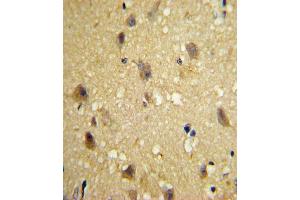 Formalin-fixed and paraffin-embedded human brain tissue with CCL2 Antibody (C-term), which was peroxidase-conjugated to the secondary antibody, followed by DAB staining. (CCL2 抗体  (C-Term))