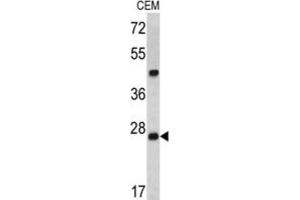 Western Blotting (WB) image for anti-Endoribonuclease Dcr-1 (Dcr-1) antibody (ABIN3001043) (Endoribonuclease Dcr-1 (Dcr-1) 抗体)