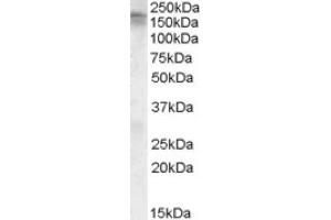 Image no. 1 for anti-Calcium Channel, Voltage-Dependent, L Type, alpha 1C Subunit (CACNA1C) (C-Term) antibody (ABIN375180) (CACNA1C 抗体  (C-Term))