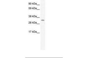 Image no. 1 for anti-PDZ and LIM Domain 1 (PDLIM1) (AA 165-214) antibody (ABIN202250) (PDLIM1 抗体  (AA 165-214))