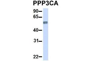 Host:  Rabbit  Target Name:  PPP3CA  Sample Type:  Human Adult Placenta  Antibody Dilution:  1.