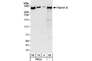 Western Blotting (WB) image for anti-Filamin B, beta (FLNB) (AA 975-1025) antibody (ABIN7453084)