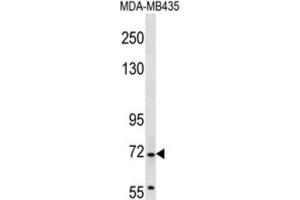 Western Blotting (WB) image for anti-Grainyhead-Like 2 (GRHL2) antibody (ABIN2997171) (GRHL2 抗体)