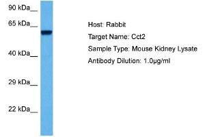 Host: Mouse Target Name: CCT2 Sample Tissue: Mouse Kidney Antibody Dilution: 1ug/ml (CCT2 抗体  (Middle Region))