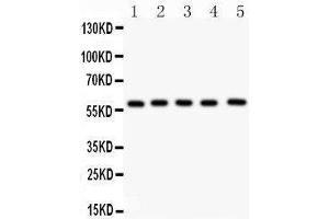 Western Blotting (WB) image for anti-Nuclear Receptor Subfamily 5, Group A, Member 2 (NR5A2) (AA 44-237) antibody (ABIN3043579) (NR5A2 + LRH1 抗体  (AA 44-237))