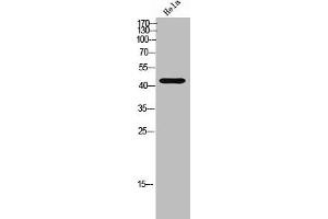 Western Blot analysis of HeLa cells using mAChR M2 Polyclonal Antibody (Muscarinic Acetylcholine Receptor M2 抗体  (Internal Region))